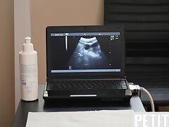 Tiny twink assfingered on ultra sound by doctor in infirmary